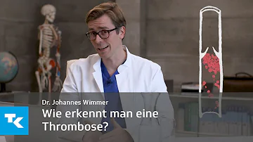 Wie kann ich testen ob ich eine Thrombose habe?