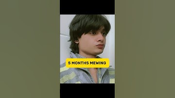 Correct Way Of Mewing✅ #indalexhartley #shortvideo #shorts #shortfeed #mewing #jawline #sharpjawline