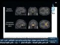  شاهد خطورة مشاهدة الأفلام الإباحية على جسم الإنسان