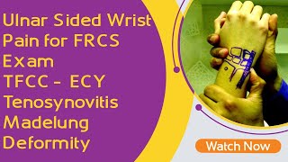 Ulnar Sided Wrist Pain for FRCS Exam | TFCC | ECY Tenosynovitis | Madelung Deformity