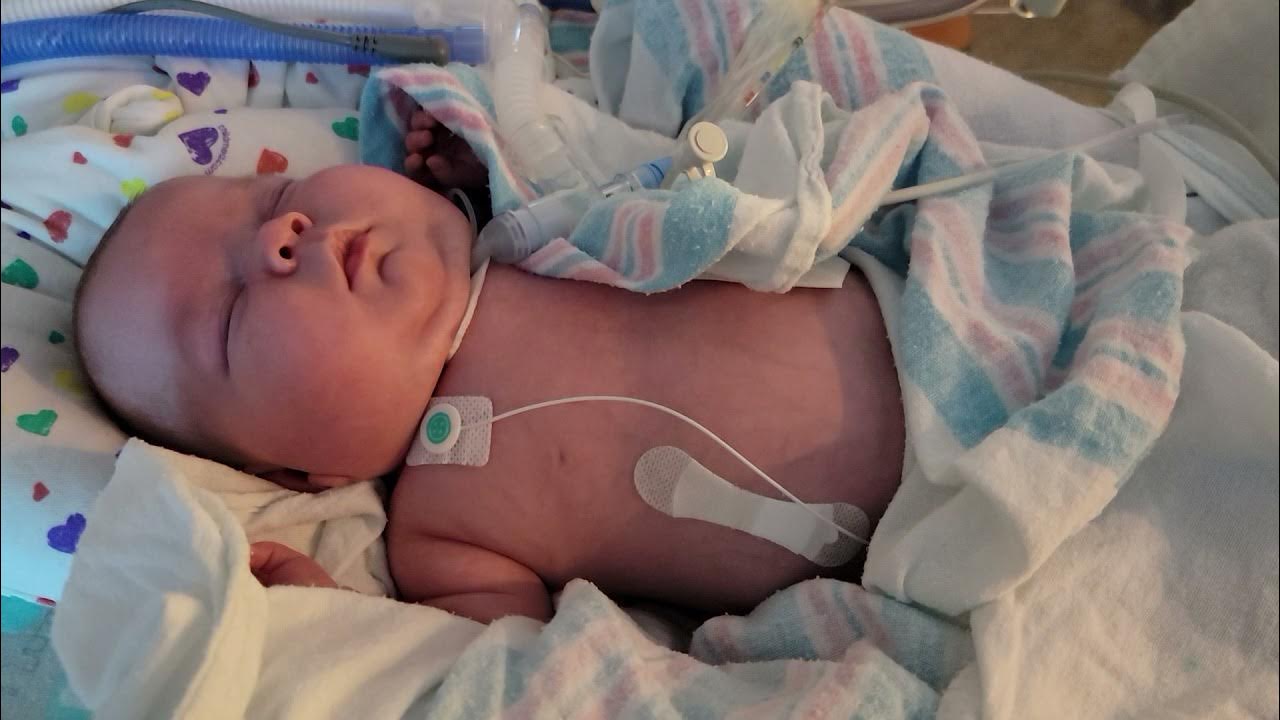 Chest Retractions YouTube