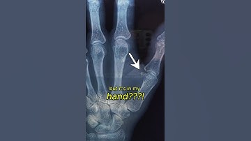 Weird bones in my body 😅 #3danimation #xray #rigging