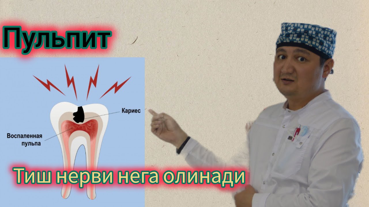 пульпит-тиш нерви