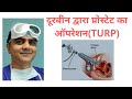 Turp surgery in delhi  dr ashish saini the best urologist in delhi