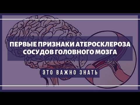 Первые симптомы атеросклероза сосудов головного мозга