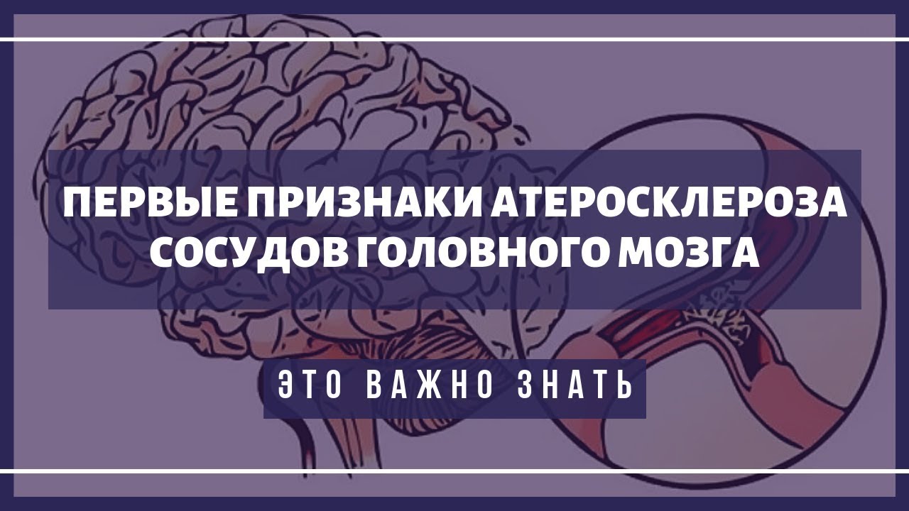 Головного мозга атеросклероз народное средство