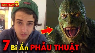 🔥 7 Bí Mật NGÃ NGỬA về Phẫu Thuật Thẩm Mỹ Mà Không Ai Nói Cho Bạn Biết | Kính Lúp TV