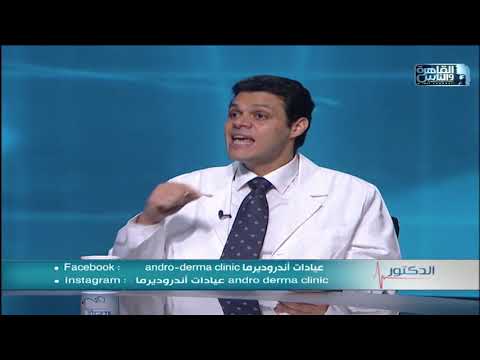 فيديو: لاحظت سوبتشاك علامات الصلع