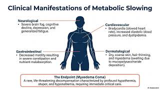 The Hypothyroidism Landscape