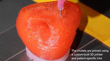 3D-Printed Organ Models