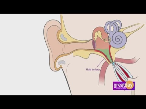 Video: Va ajuta prednisonul lichidul din ureche?