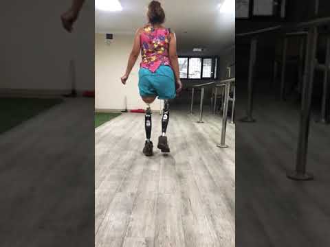 زراعة الأطراف الصناعية الاولى في تركيا الاولى والشرق الأوسط