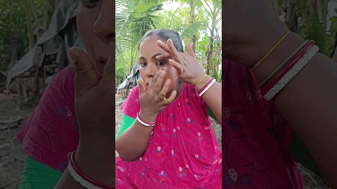 MY EYEBALL SLIPPED OUT