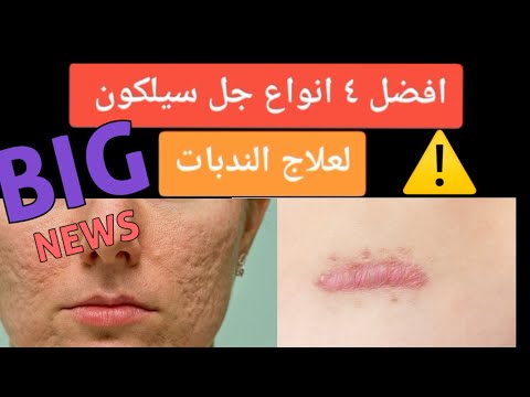 اقوي4 انواع للجل السيليكون لعلاج الندبات والتخلص اثار جروح قديمه وآثار العمليات الجراحية والولاده