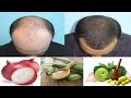 How to Stop Hair loss and grow hair faster - 7 Natural Hair remedies to try at home