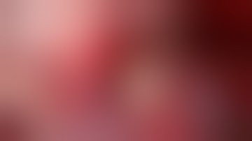 Microvascular Decompression Operative Video