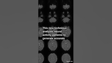 Mind-Captioning Technology Translates Mental Images Into Text Using Br