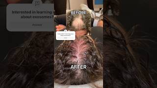 Are Stem Cells That Talk To Your Other Cells To Help Them