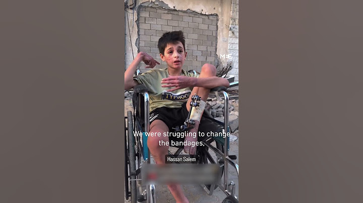Palestinian child describes injuries from Israeli missile strike on Unrwa bus