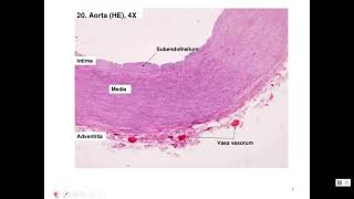 CVS BLOOD VESSELS & PRESSURE  Part 1
