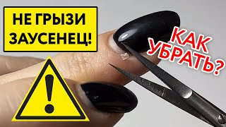 видео: Ошибки домашнего маникюра: заусенец на пальце и боковые валики ногтя картинка: Ошибки домашнего маникюра: заусенец на пальце и боковые валики ногтя