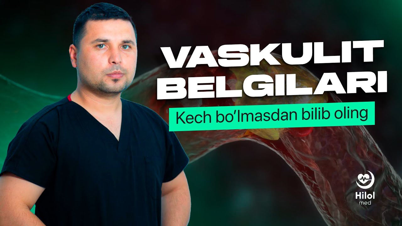Vaskulit haqida bilishingiz shart! Vaqtida davolanmasangiz nima bo‘ladi?