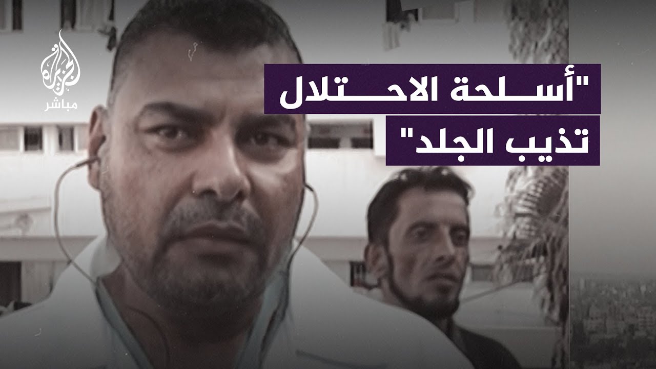 المتحدث باسم الصحة في غزة: الاحتلال يستخدم أسلــ ـحة تُذيب الجلد لم نشهدها من قبل
