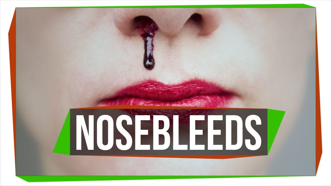 Why Do We Get Nosebleeds