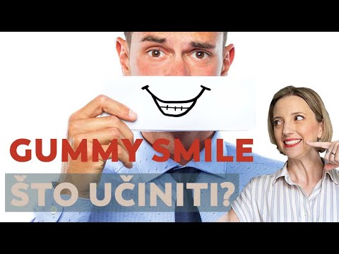 GUMMY SMILE - višak zubnog mesa se itekako može riješiti! Opcije, procedura, primjeri...