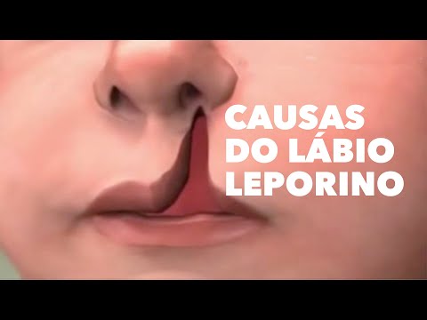 causas do lábio