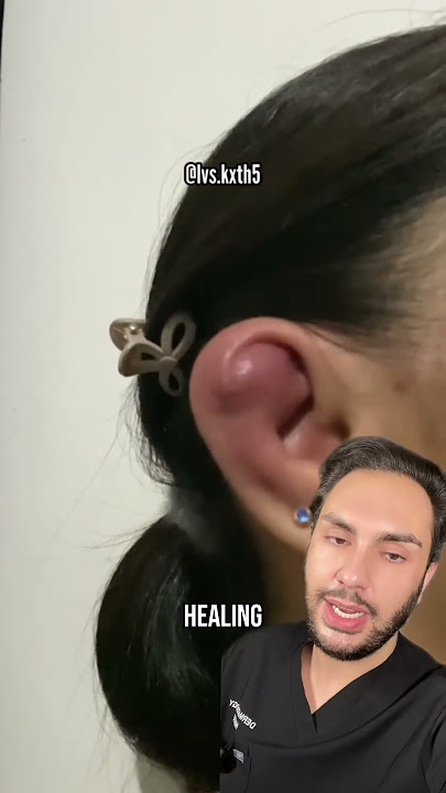 NEVER pierce your ears with THIS