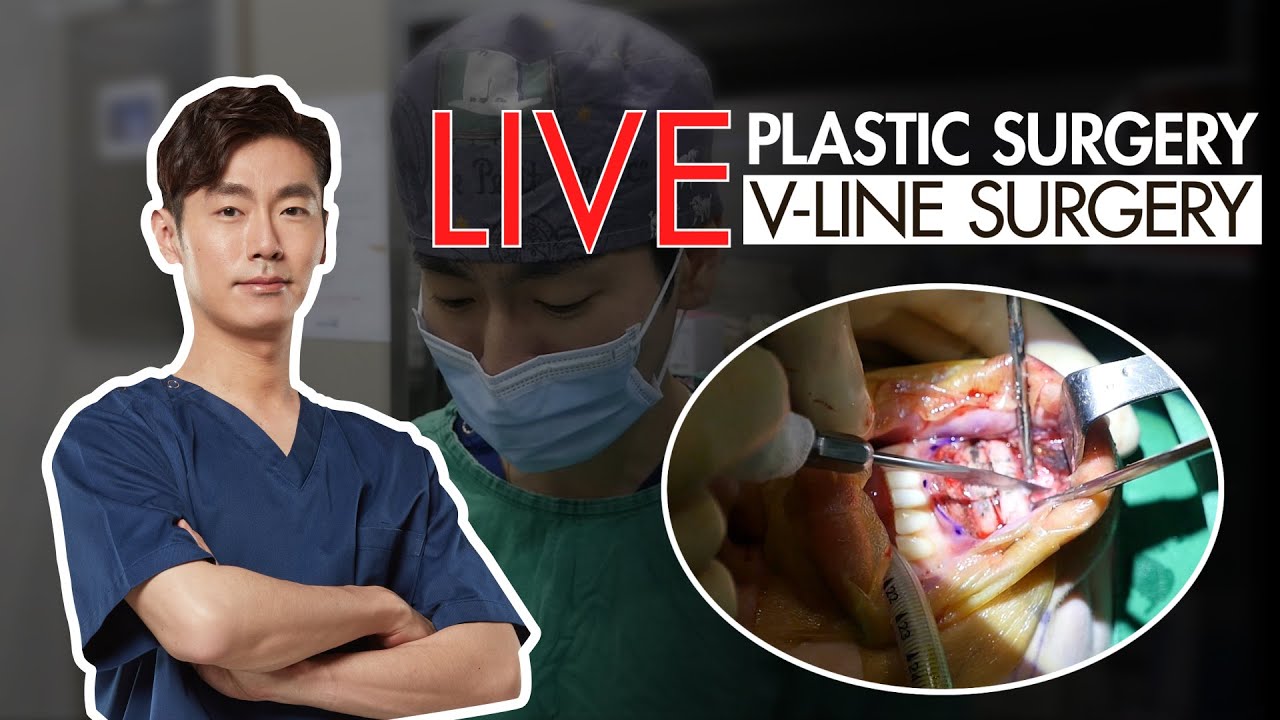 Live Plastic Surgery Video_V-Line Surgery 📍