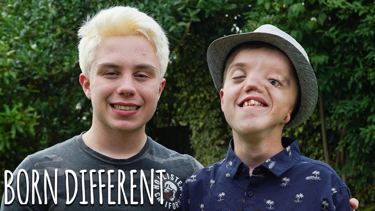 Twin Brothers Are The Same But Different | BORN DIFFERENT