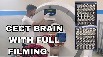 CECT BRAIN WITH FULL FILMING 🎞️ // GE Machine / #radiology #ct #viralvideo