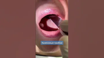 не болейте(медицинская манипуляция)