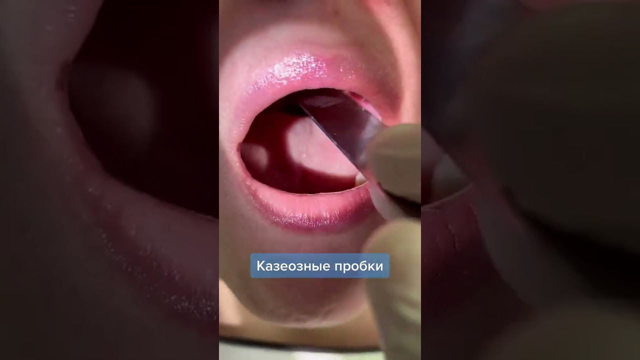 не болейте(медицинская манипуляция)