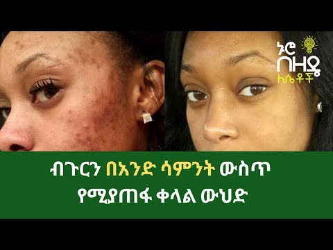 ቪዲዮ: ሜላስማ ለማስወገድ 3 መንገዶች