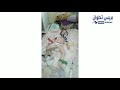 من ينقذ طفلة يتيمة من مرض عضال من ينقذ طفلة يتيمة من مرض عضال