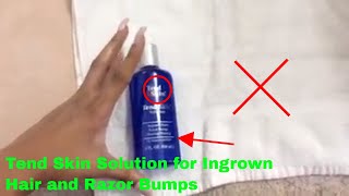 How To Use Tend Skin Solution For Ingrown Hair And Razor Bumps Review