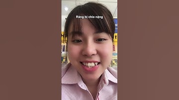 Phần 1 - 3 điểm bất ổn khi niềng răng bằng khay trong suốt! Nha khoa Thành An