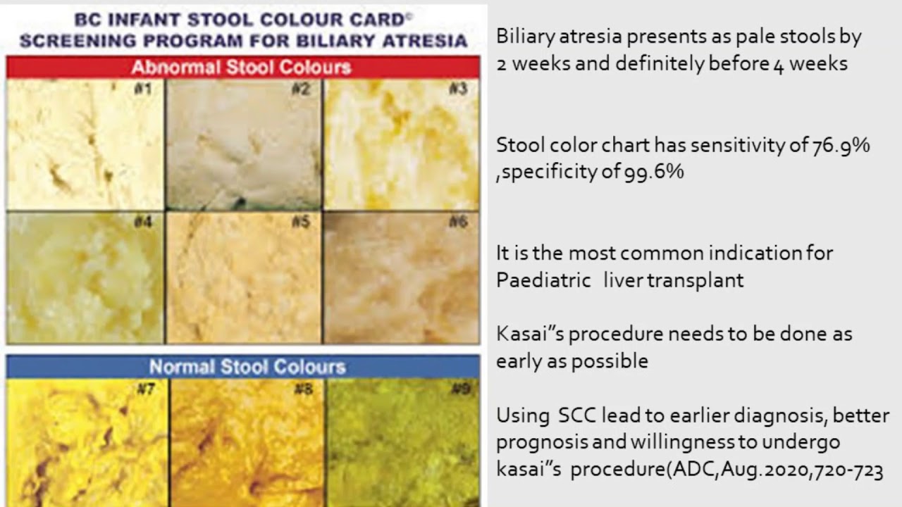 12 free printable stool color charts word pdf download stool color