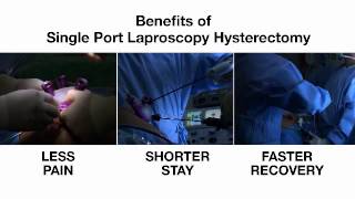 Single-Port Laparoscopy Hysterectomy