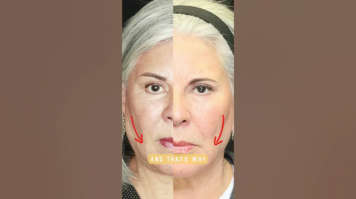 Breakdown | Brow Lift & Blepharoplasty ( Eyelid) | Dr. George Orloff