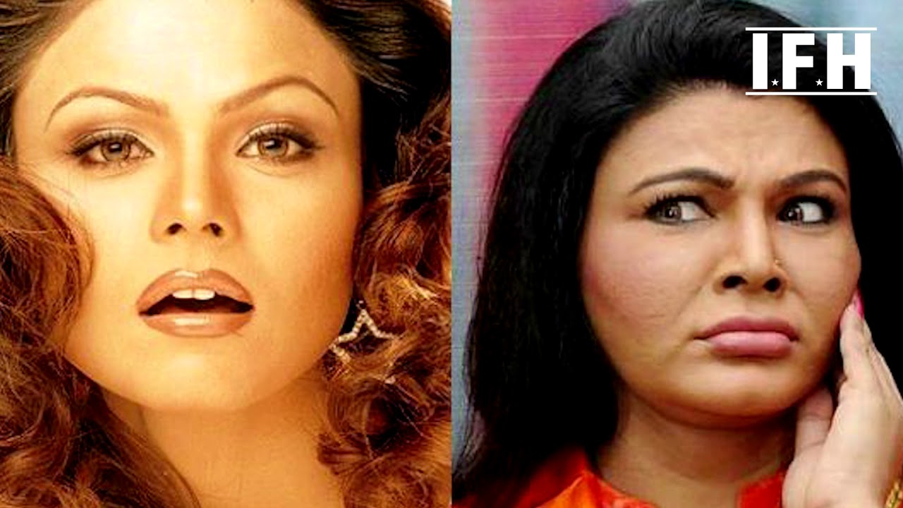 Rakhi Sawant Reveals Her Surgery | Indian Film History official secrets
