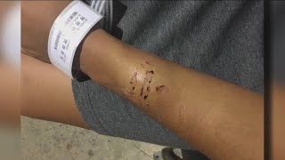 Stray cat warning Warning May Be Upsetting Cat With Rabies