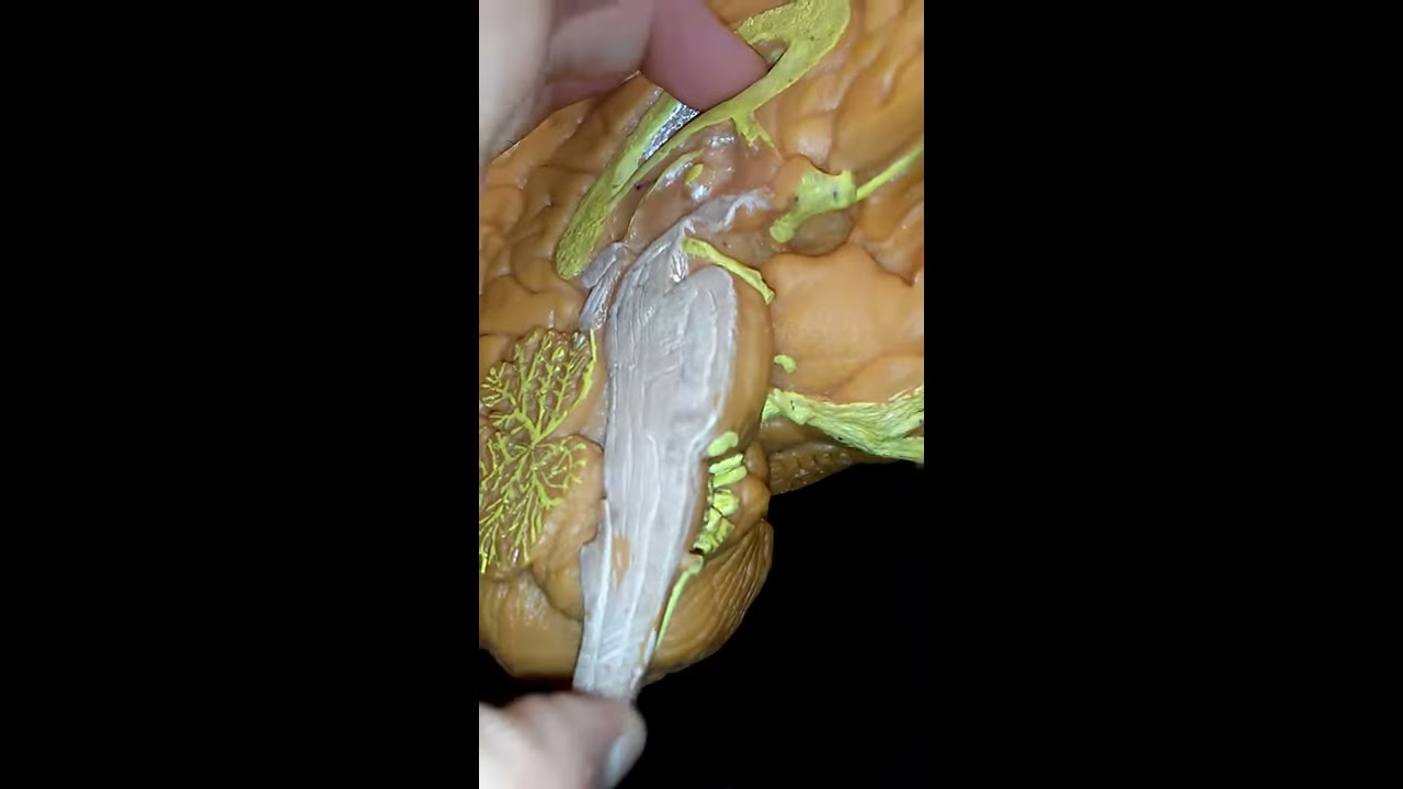Medulla Oblongata And Pyramids