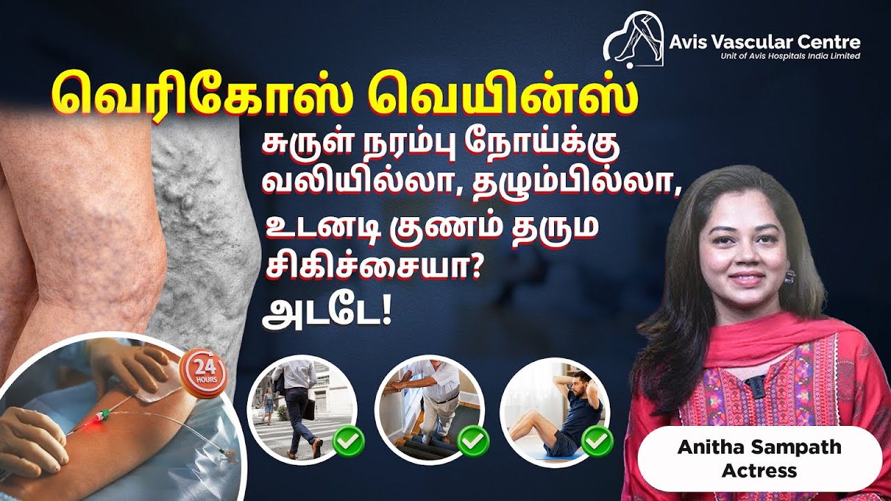 Varicose Veins - Pain-Free, Scar-Free Treatment for Immediate Relief!