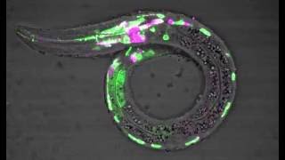 Visualization of RNA processing patterns of an insulin receptor gene in C. elegans