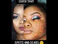 How to cover dark spots and scars