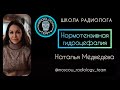 НОРМОТЕНЗИВНАЯ ГИДРОЦЕФАЛИЯ  (НТГ)/НАТАЛЬЯ МЕДВЕДЕВА/MOSCOW RADIOLOGY TEAM